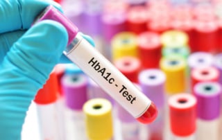 Center for Family Medicine How Often Should Diabetics Have Their HbA1c Checked