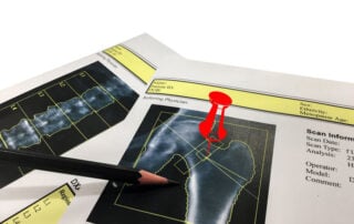 center-for-family-medicine-Osteopenia-vs-Osteoporosis-Whats-The-Difference-_-How-To-Fight-Low-Bone-Density